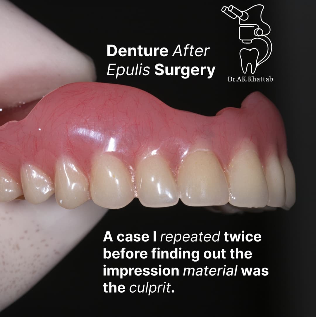 Denture and Epulis Surgery