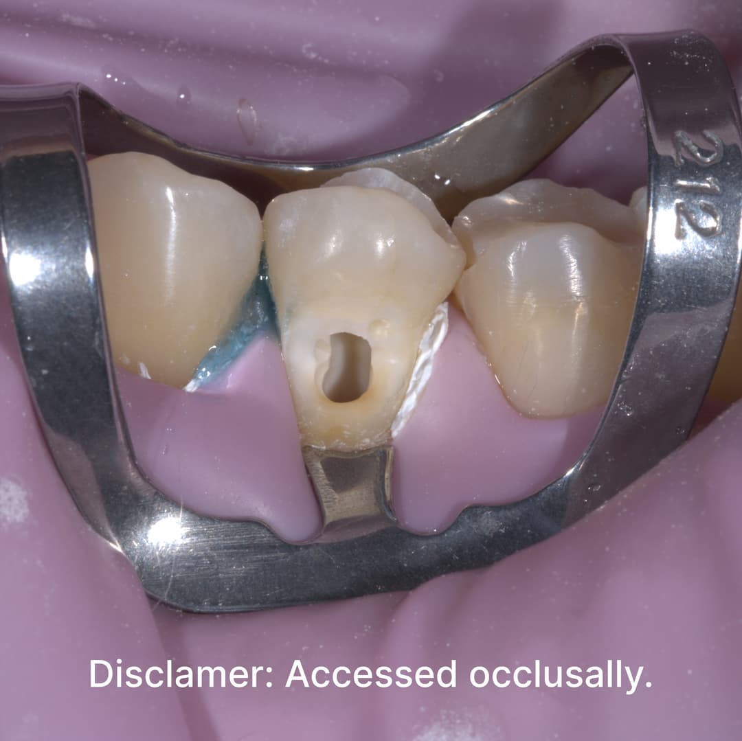 Buccal Cavity Isolation.